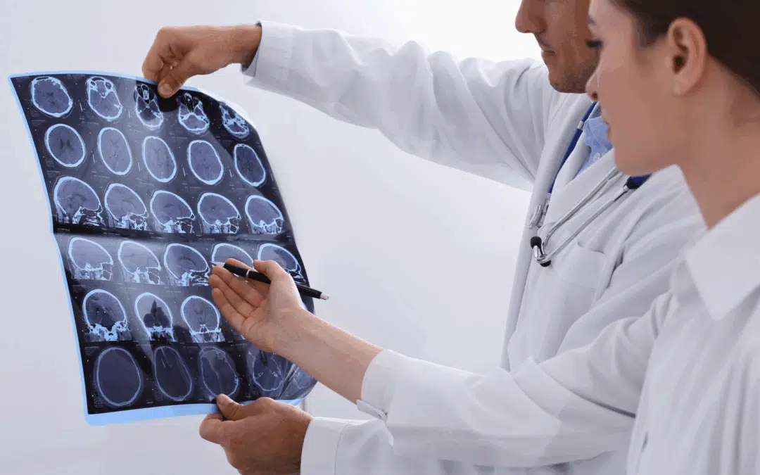 Physiotherapie bei Multiple Sklerose: Schmerzfrei leben mit diesen Übungen